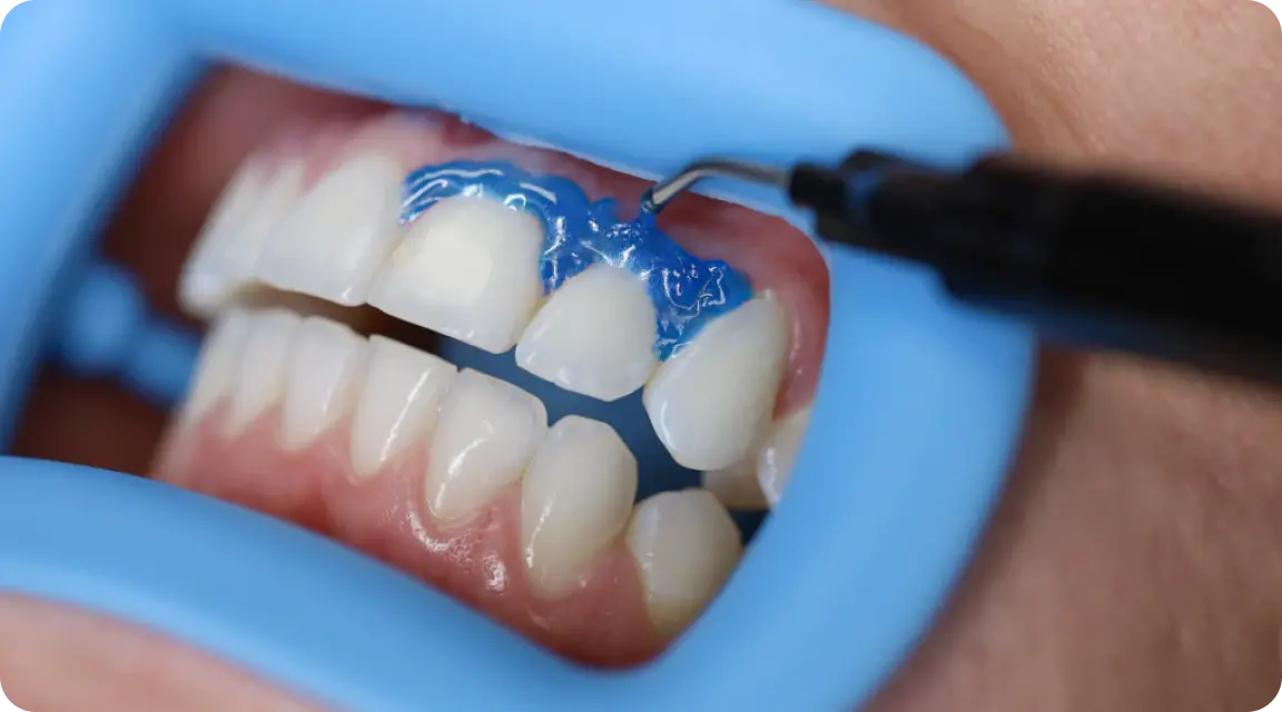 Sensitivity Protection